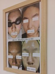 -美肤盾祛痘·问题肌头疗管理中心