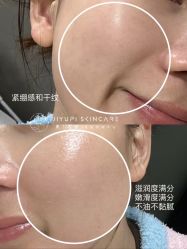 -MLP美丽派·问题肌疗愈中心