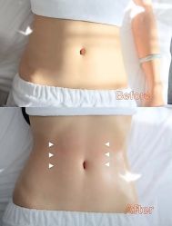 -Lily纤美·科技减脂中心