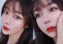 -北京米扬丽格医疗美容·联合丽格鼻整形中心