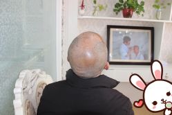 -大麦微针植发丨全国连锁