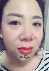 点击看大图 果冻唇-光SPA科技美肤