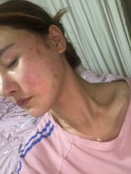 -洁铭新加坡医美