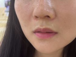 -广州美莱医疗美容医院