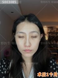 -丰联丽格医疗美容·联合丽格眼整形中心