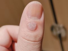 -上海市皮肤病医院(武夷路院区)