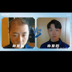 -极客侠男士假发定制补发
