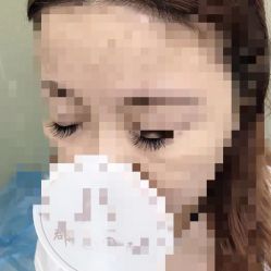 -郡艺医疗美容·微整·眼鼻吸脂