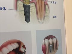 -圣呗口腔·舒适化种植牙·矫正中心(广州总院)