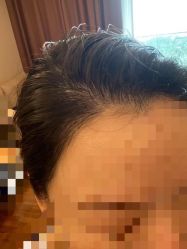 -熙朵美学植发·连锁品牌