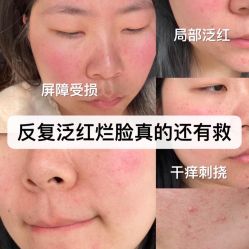 -Cream88颜皮肤管理中心