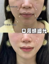 -深圳艺星医疗美容医院