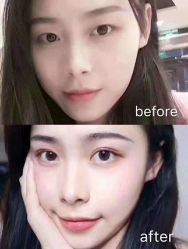 -深圳鹏爱悦心医疗美容医院