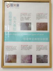 -靓芙泉专研痘痘肌