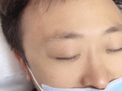 -德绣·机器野生眉发际线·美瞳线半永久
