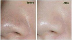 -厦门美莱整形美容医院