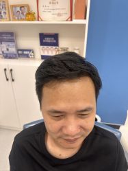 -大麦微针植发全国连锁