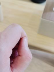 -清疣美疣·痣·斑净肤中心