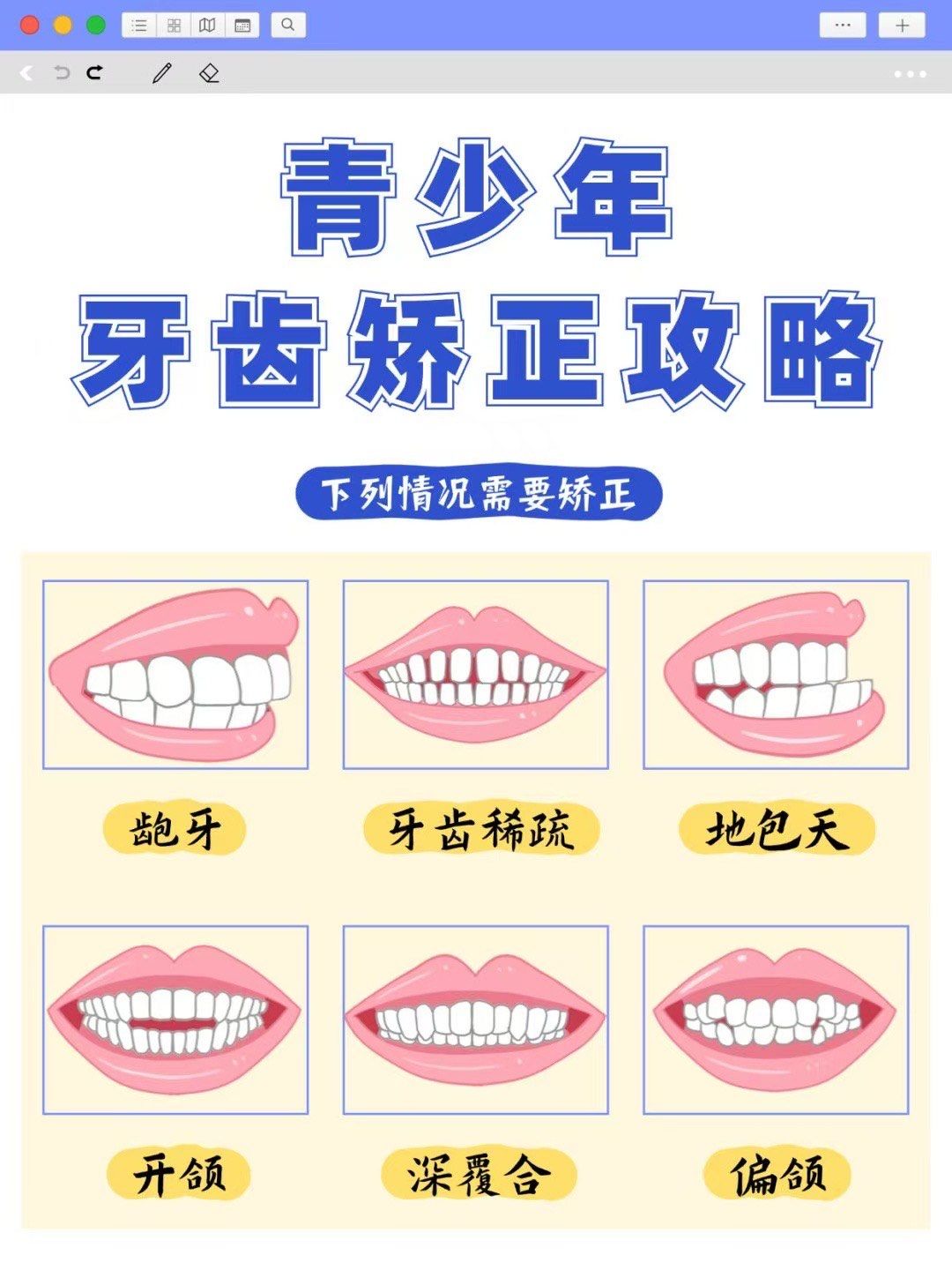 青少年牙齿矫正方法怎么选?