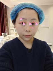 体验后-武汉颜范薇美医疗美容门诊部