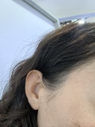 -清疣美疣·痣·斑净肤中心