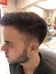 -大麦微针植发丨全国连锁