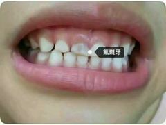 -王晓峰牙科(府前街院区)