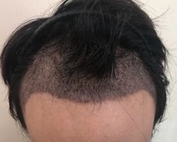 -八大处整形