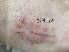 -特一安24小时宠物医院·骨科·中兽医