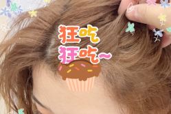 -大麦微针植发全国连锁