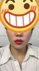 体验后-纯粹医美