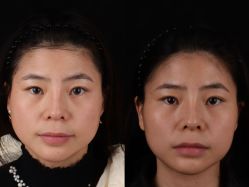 -杭州米兰柏羽医疗美容医院