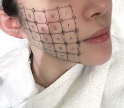 -杭州米兰柏羽医疗美容医院