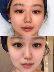 体验前-针美汇欧邦医疗美容
