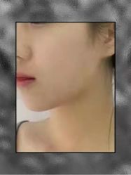 -东剑医学美容·注射美学中心