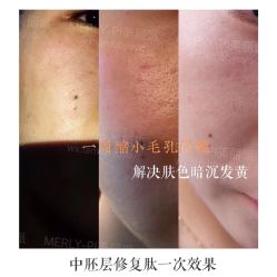 -MLP美丽派·问题肌疗愈中心