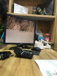 -章光101养发生发防脱发