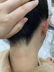 -小梨·OndaPro·专业脱毛连锁机构