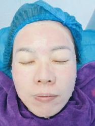 体验后-重庆联合丽格美容医院