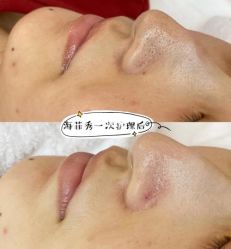 体验前-南京医科大学友谊整形外科医院