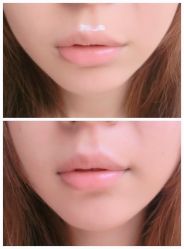 -SKINIST丽铂医疗美容