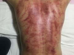 -正宜按摩养生坊(建设局店)