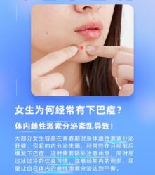 -蕾特恩·专业祛痘国际连锁