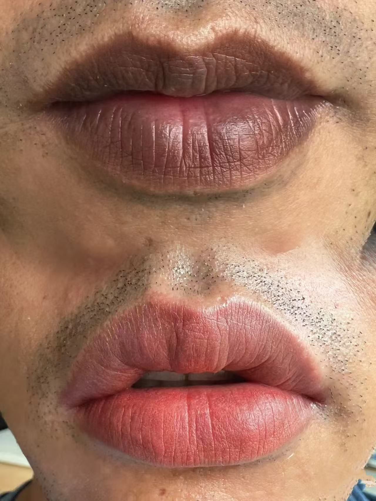 男士"乌唇"的看过来!