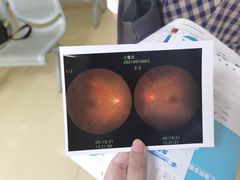 -上海大学附属上海和平眼科医院