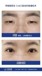 -丰联丽格医疗美容·联合丽格眼整形中心