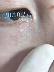 -美人痣全国连锁