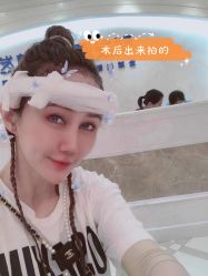 -大麦微针植发全国连锁