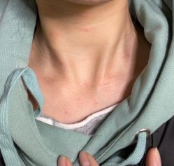 -痣清宫祛斑祛痣连锁店