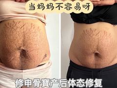 -修申骨雕小颜脊柱骨盆管理产后修复